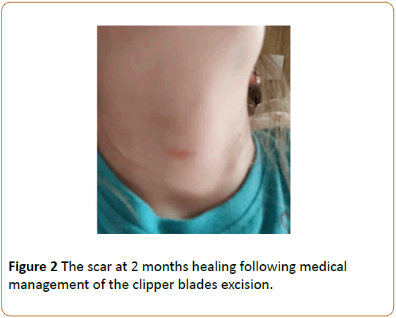 pediatric-emergency-care-blades-excision