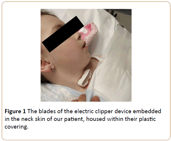 pediatric-emergency-care-electric-clipper