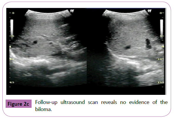pediatric-emergency-care-ultrasound-scan